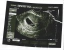Ultrasound.jpg